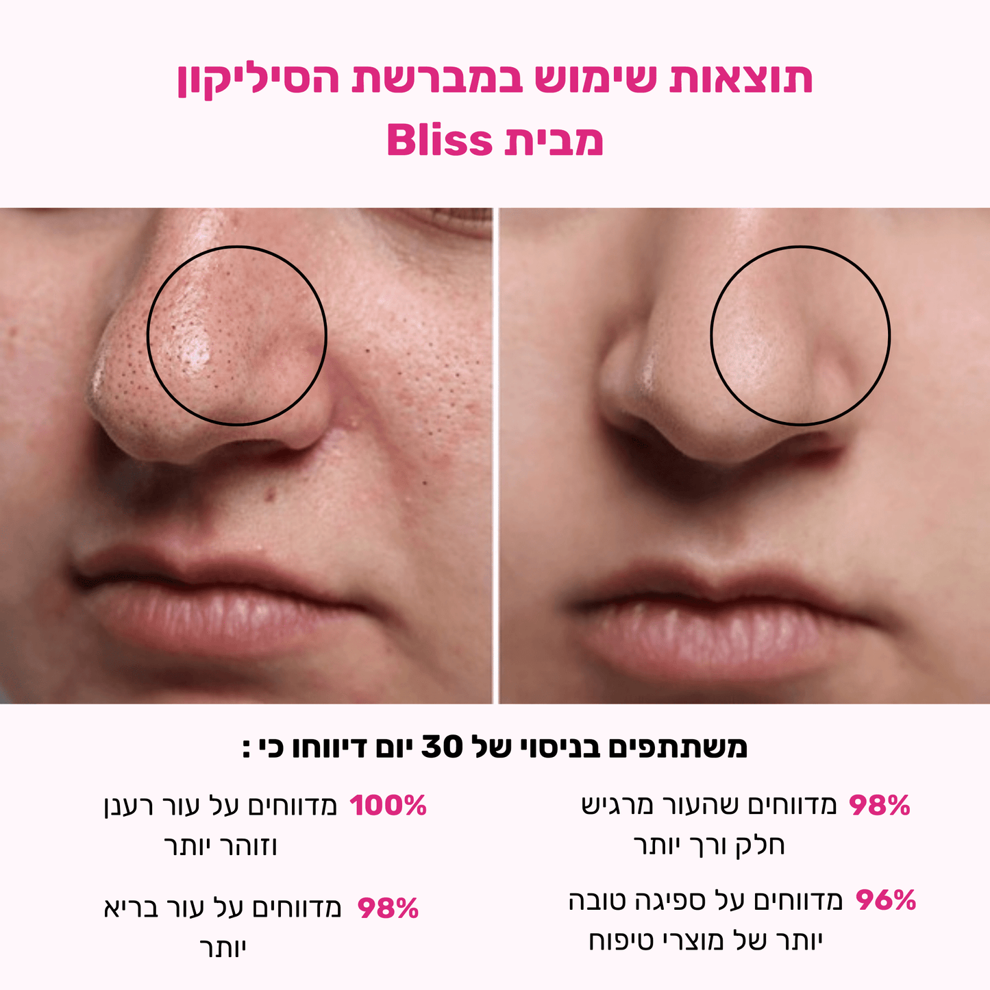 מברשת סיליקון אלקטרונית לפנים - BLISS SHOP