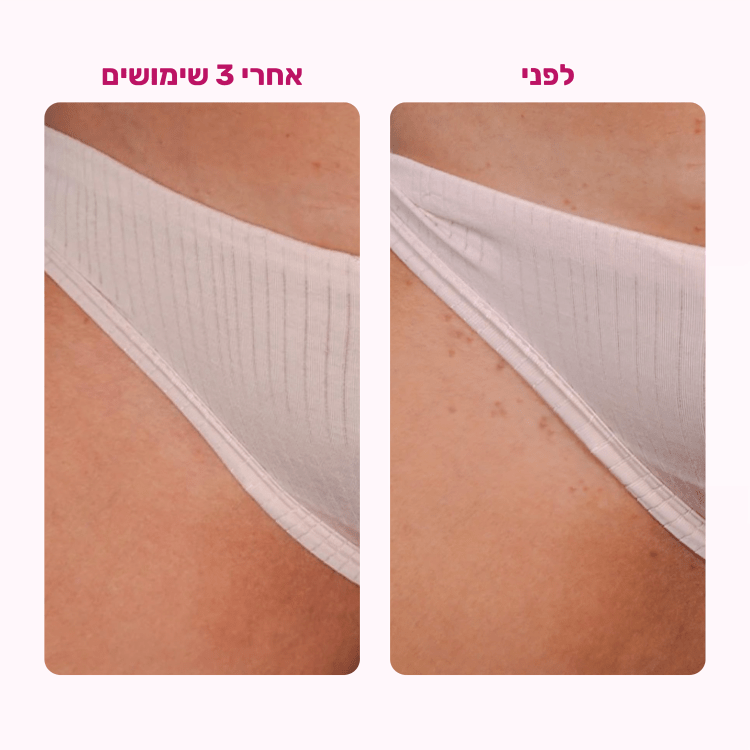 מכונת הגילוח של BLISS - BLISS SHOP