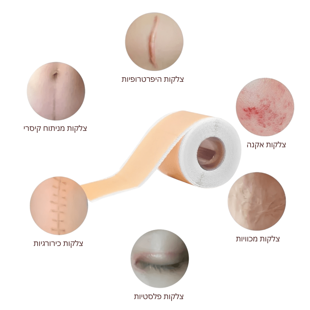 SkinFix - יריעות סיליקון לטיפול בצלקות וקמטים - BLISS SHOP