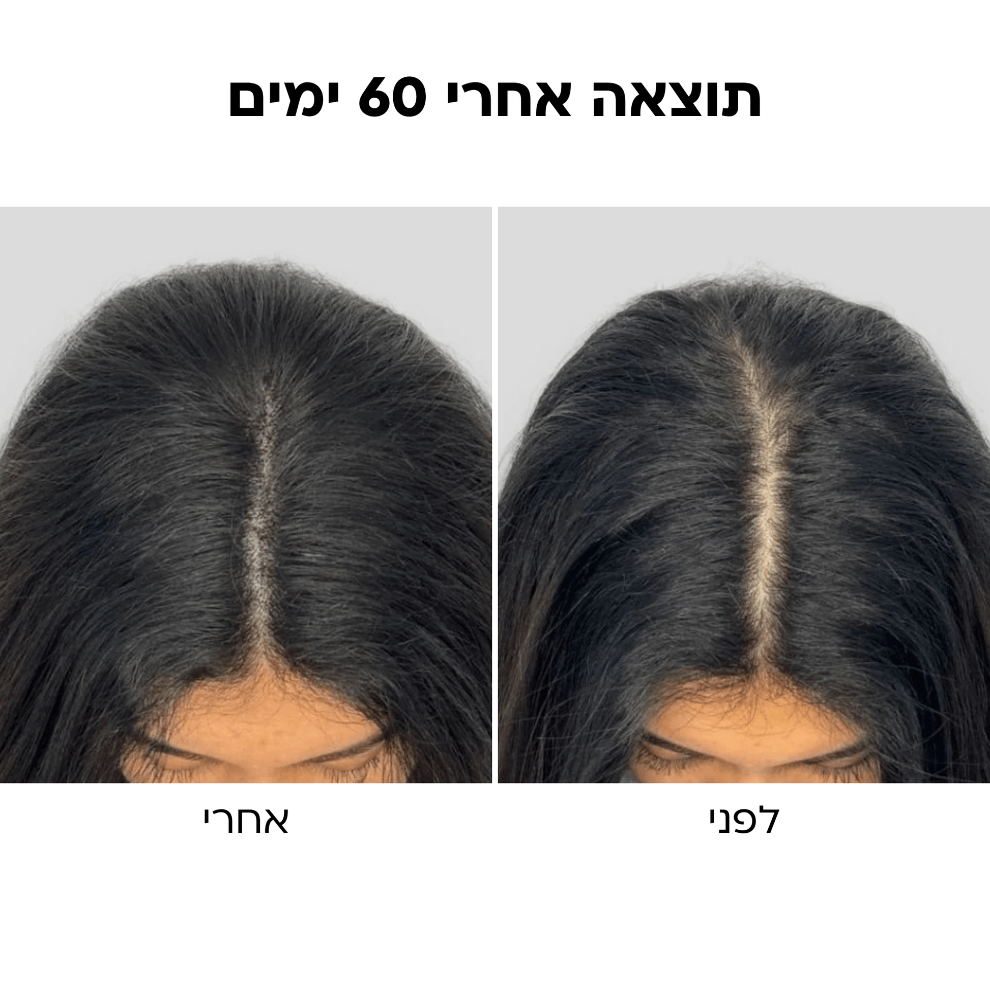 BlissBrush™ מברשת ה - 4 ב - 1 לשיער מלא וחזק יותר - BLISS SHOP