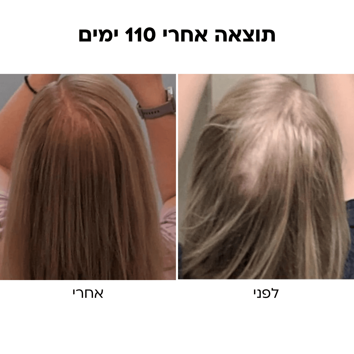 BlissBrush™ מברשת ה - 4 ב - 1 לשיער מלא וחזק יותר - BLISS SHOP