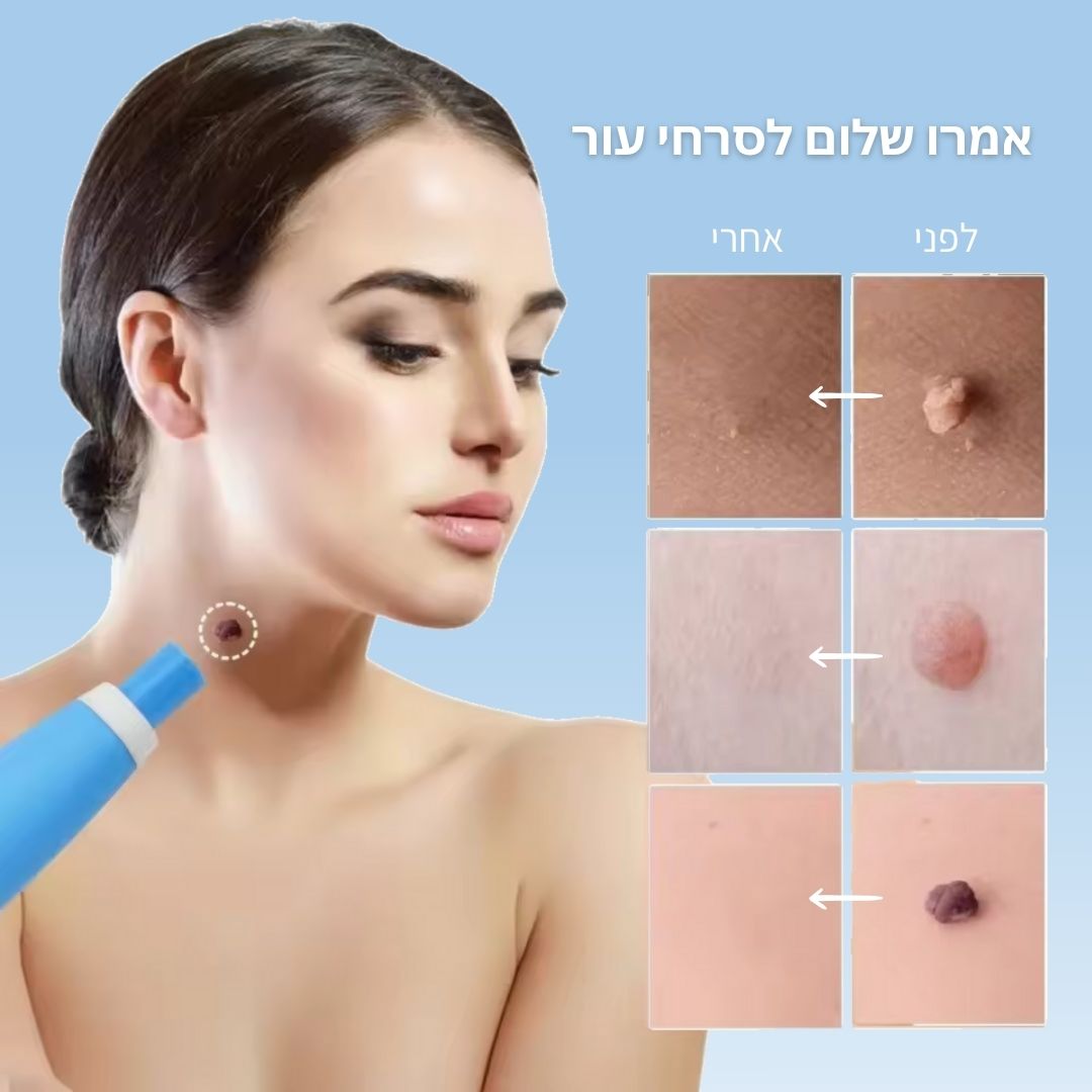 BlissMed™ - ערכה להסרת סרחי עור - BLISS SHOP