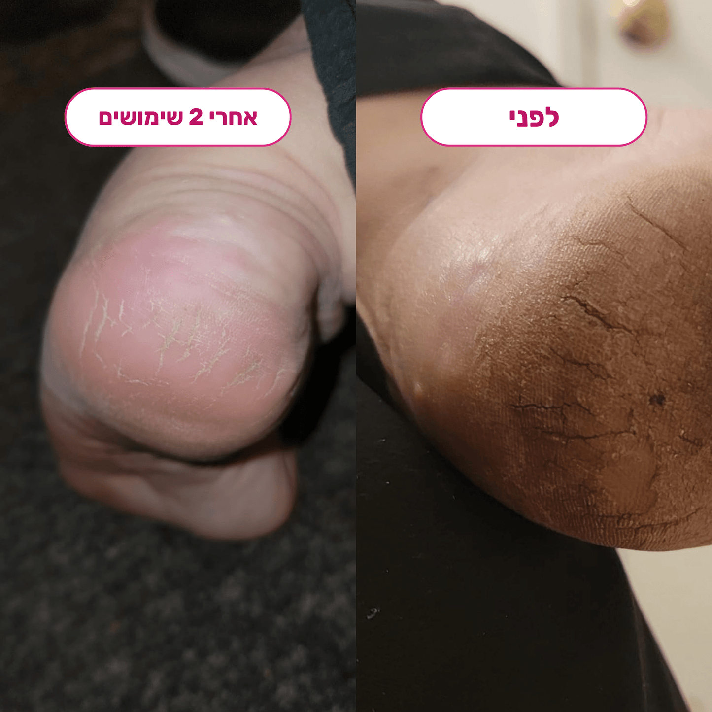 מארז הפדיקור של Bliss - BLISS SHOP