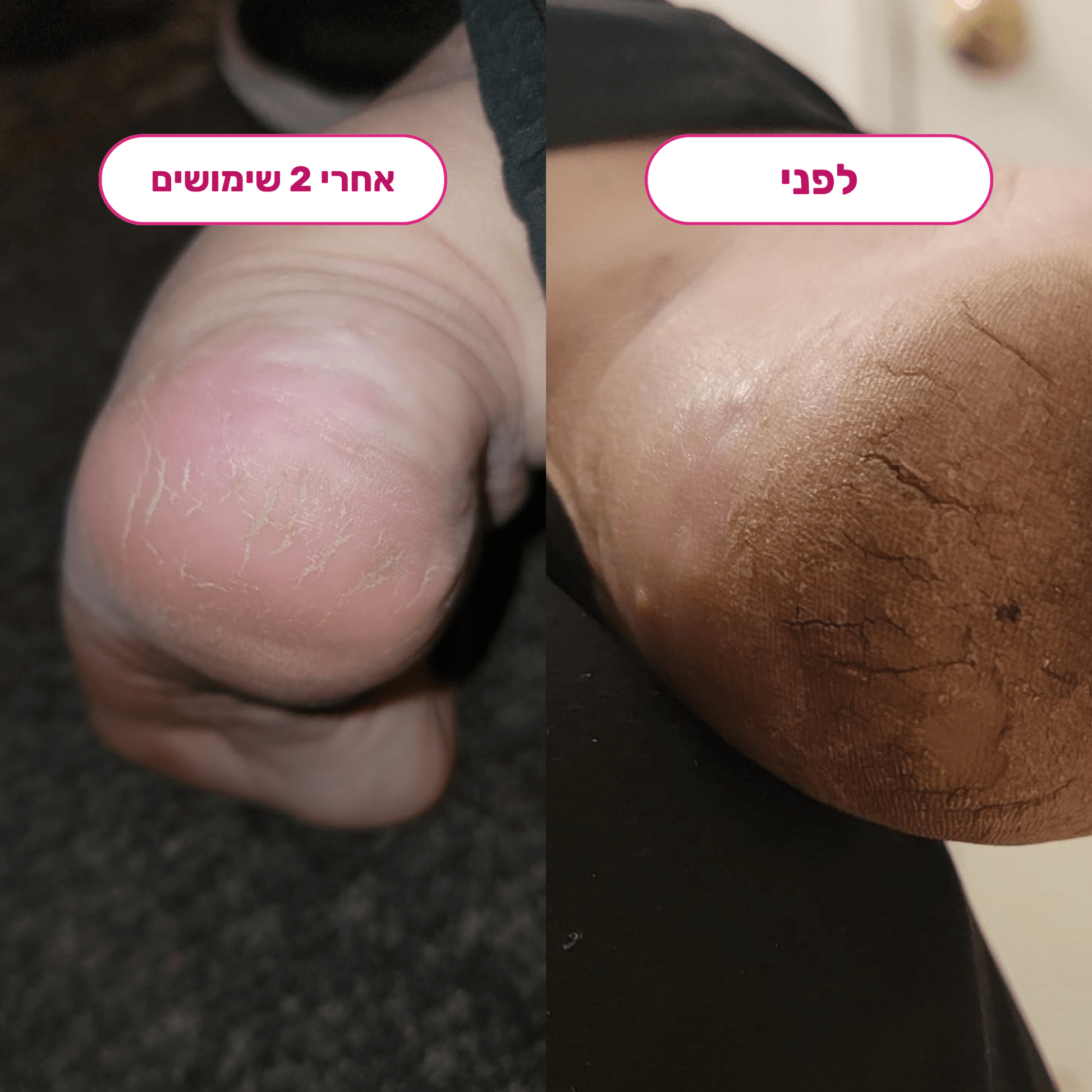 מארז הפדיקור של Bliss - BLISS SHOP