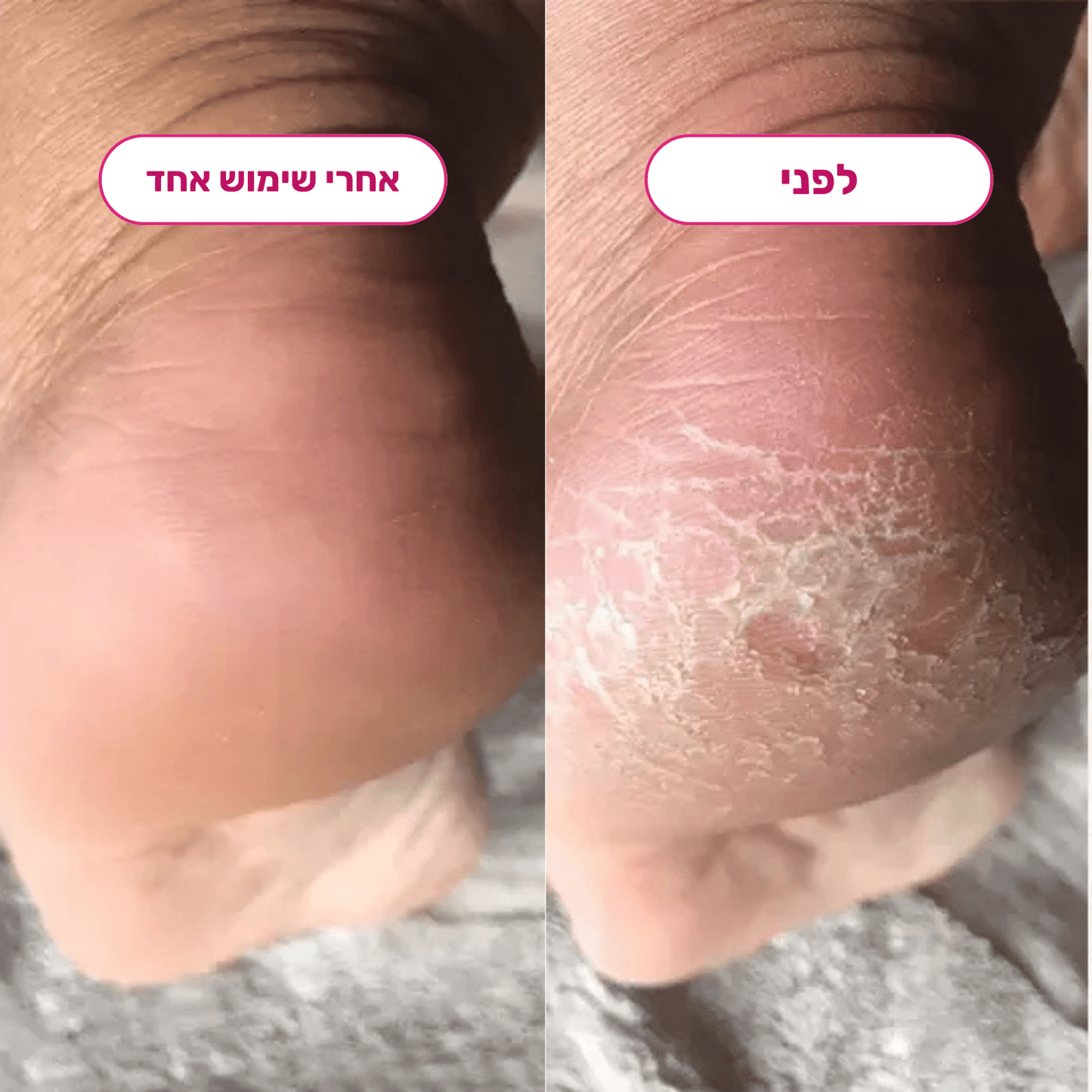 מארז הפדיקור של Bliss - BLISS SHOP