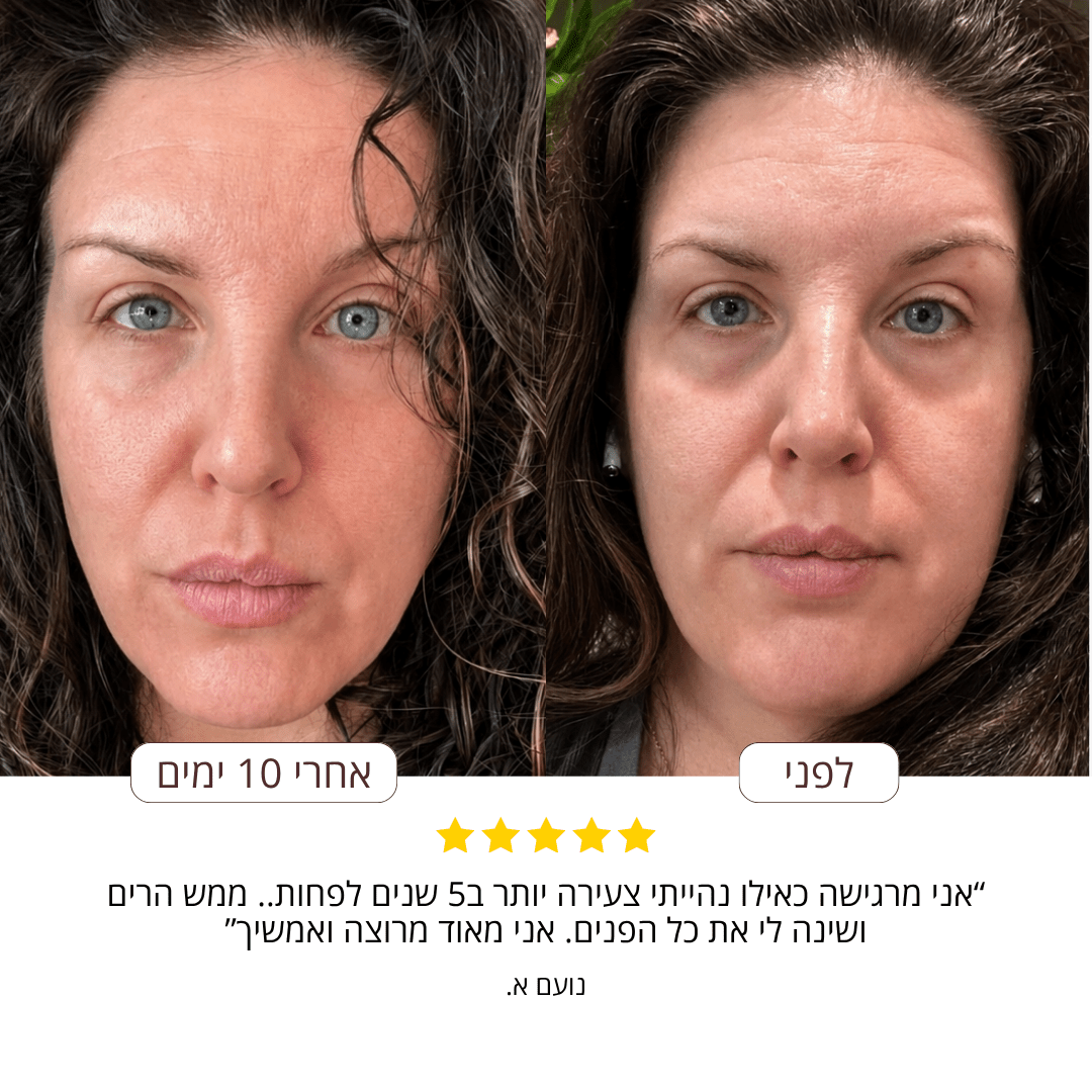 SilkySkin- רצועות סיליקון להחלקת קמטים - BLISS SHOP