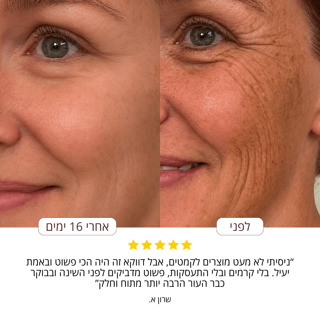 SilkySkin- רצועות סיליקון להחלקת קמטים - BLISS SHOP
