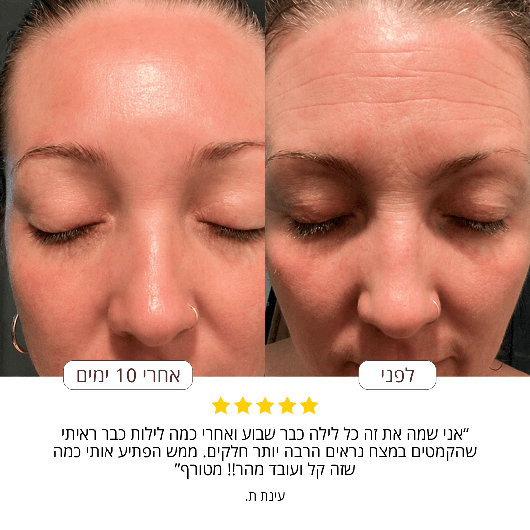 SilkySkin- רצועות סיליקון להחלקת קמטים - BLISS SHOP